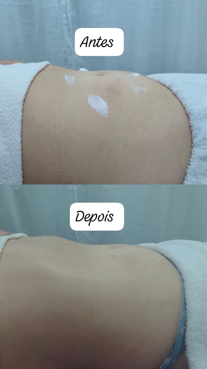 Sessão de massoterapia Aura Spa
